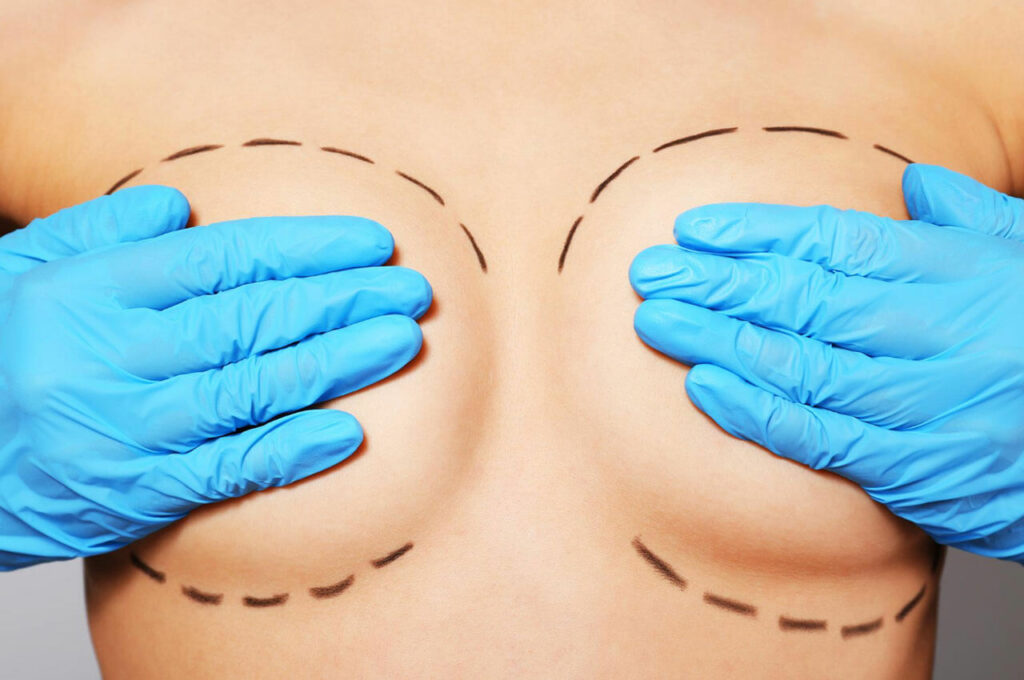 Brustvergrößerung Frankfurt