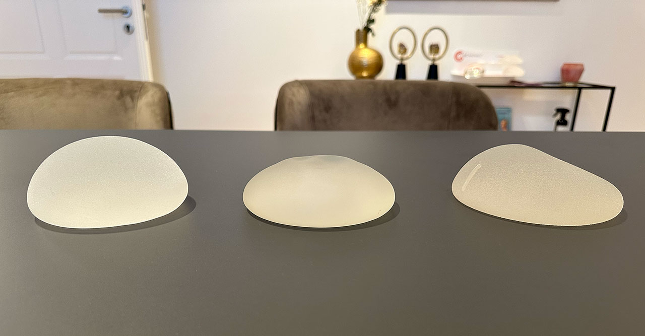 Brustvergrößerung mit Implantaten